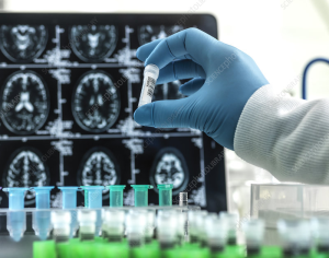 Alzheimer’s Research: Advancements by Beth Stevens
