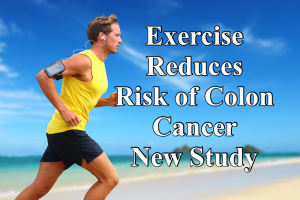 Colon Cancer Exercise: Boosting Survival Rates Post-Treatment